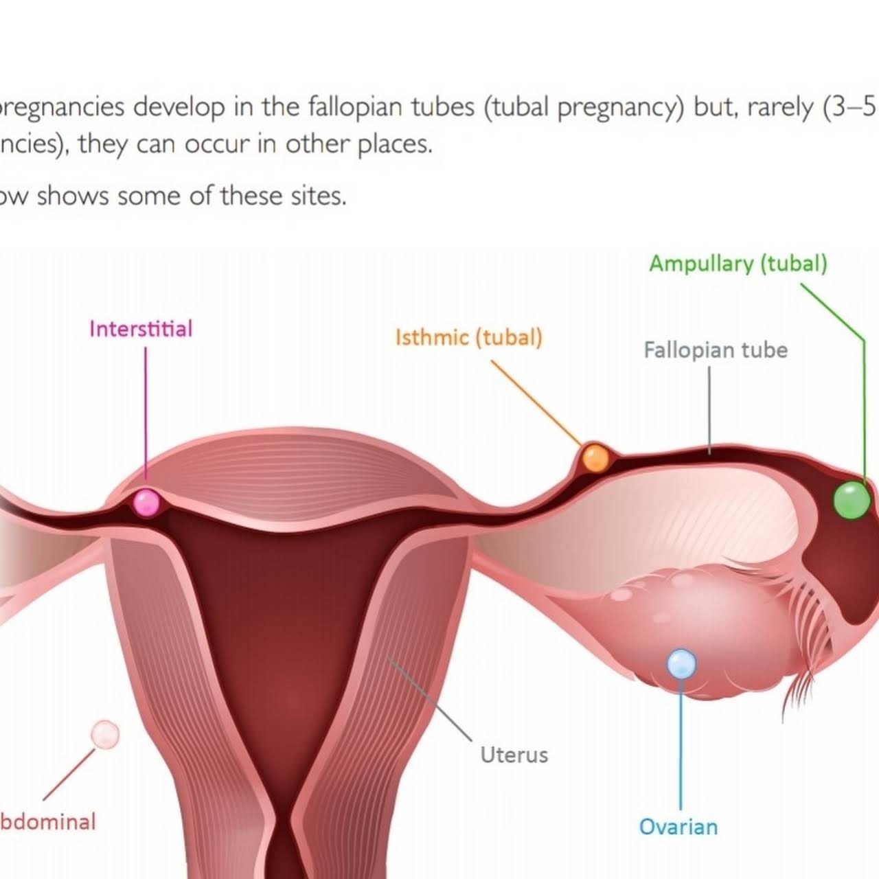 Best gynaecologist in thane