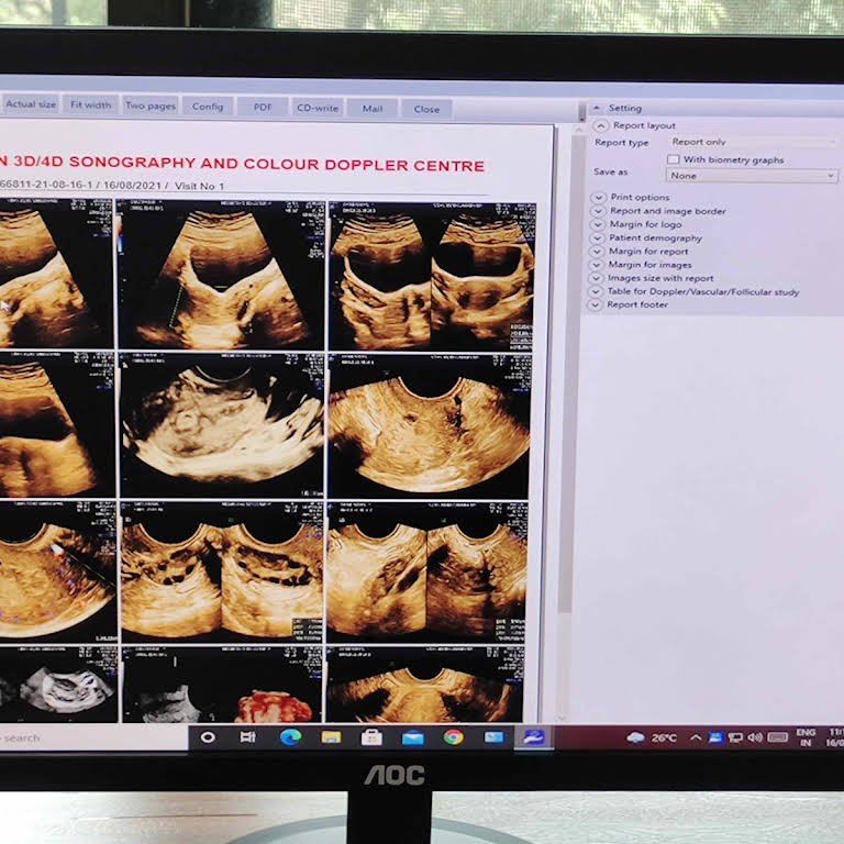 Best gynaecologists in thane